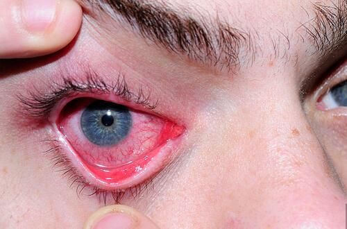 红眼加强了多少（红眼伤害增加）-图1