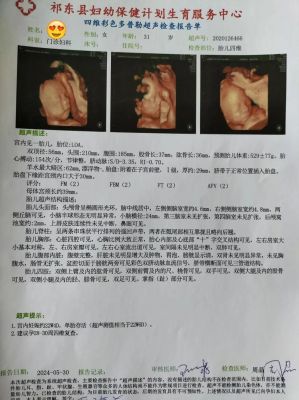 多少z(多少周做四维彩超是最佳时期)-图2 多少z(多少周做四维彩超是最佳时期)-图2